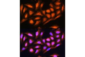 Immunofluorescence analysis of U2OS cells using PSMD4 Rabbit pAb (ABIN3021329, ABIN3021330, ABIN3021331 and ABIN6214913) at dilution of 1:100.