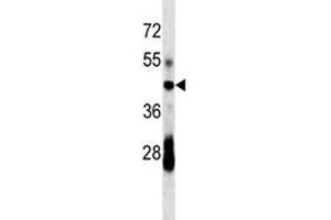 CD79a antibody western blot analysis in mouse spleen tissue lysate.