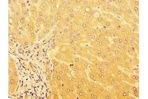 Immunohistochemistry of paraffin-embedded human liver tissue using ABIN7164477 at dilution of 1:100 (GPR179 anticorps  (AA 1440-1671))
