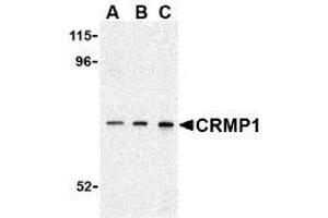Western blot analysis of CRMP1 in 3T3 cell lysate with AP30242PU-N CRMP1 antibody at (A) 0. (CRMP1 anticorps  (C-Term))