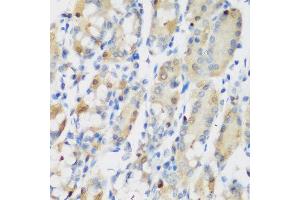 Immunohistochemistry of paraffin-embedded human gastric using RRM1 antibody at dilution of 1:200 (40x lens). (RRM1 anticorps)