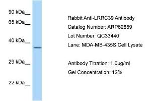 Western Blotting (WB) image for anti-Leucine Rich Repeat Containing 39 (LRRC39) (C-Term) antibody (ABIN2789270) (LRRC39 anticorps  (C-Term))