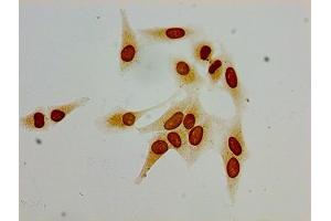 Immunocytochemistry analysis of Hela cells using ABIN7139190 at dilution of 1:100