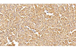 Detection of HMGCR in Porcine Cardiac Muscle Tissue using Polyclonal Antibody to 3-Hydroxy-3-Methylglutaryl Coenzyme A Reductase (HMGCR)