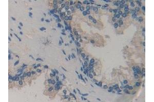 Detection of BGN in Human Prostate Tissue using Polyclonal Antibody to Biglycan (BGN)