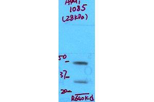 Aquaporin 1 Western Blot. (Aquaporin 1 anticorps  (N-Term))