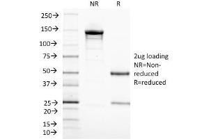 SDS-PAGE Analysis Purified CD3 epsilon Monoclonal Antibody (C3e/1308). (CD3 epsilon anticorps  (AA 23-119))