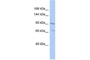 WB Suggested Anti-RALGDS Antibody Titration: 0.