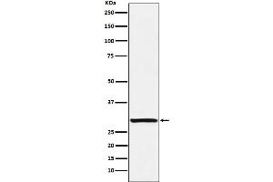 Western blot analysis of Intra Acrosomal Protein expression in Human testis lysate.