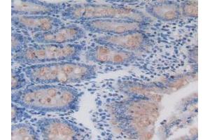 Figure. (REG3B anticorps  (AA 27-175))