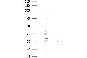 Western blot analysis of lysates from HUVEC cells(UV,30 min treatment), using RNase H1 Antibody at 1/1000 dilution.