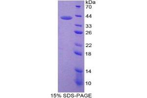 SDS-PAGE analysis of Mouse Neuromedin B Protein.