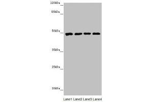 Western blot All lanes: CYP3A43 antibody at 2. (CYP3A4 anticorps  (AA 244-503))