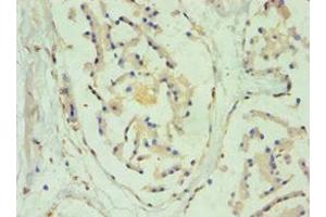 Immunohistochemistry of paraffin-embedded human prostate tissue using ABIN7170965 at dilution of 1:100