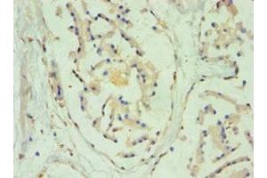 Immunohistochemistry of paraffin-embedded human prostate tissue using ABIN7170965 at dilution of 1:100 (SULT2B1 anticorps  (AA 1-365))