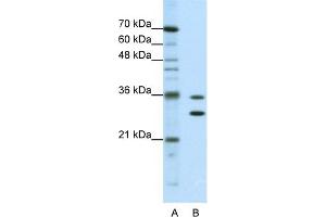 WB Suggested Anti-MTHFSD Antibody Titration:  0. (MTHFSD anticorps  (N-Term))