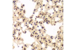 Immunohistochemistry of paraffin-embedded rat lung using CSNK2 antibody (ABIN6127663, ABIN6139128, ABIN6139129 and ABIN6217497) at dilution of 1:100 (40x lens).