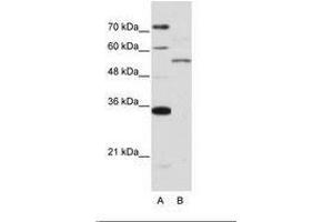 Image no. 1 for anti-Zinc Finger Protein 707 (ZNF707) (AA 26-75) antibody (ABIN6736219) (ZNF707 anticorps  (AA 26-75))