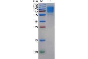 Human GC Protein, His Tag on SDS-PAGE under reducing condition.