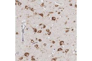 Immunohistochemical staining of human cerebral cortex with FAM167B polyclonal antibody  shows strong cytoplasmic positivity in neuronal cells. (FAM167B anticorps)