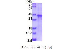 SDS-PAGE (SDS) image for RAS-Like, Family 12 (RASL12) (AA 1-266) protein (His tag) (ABIN5853954)
