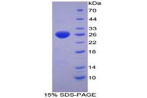 SDS-PAGE analysis of Mouse TrxR1 Protein. (TXNRD1 Protéine)