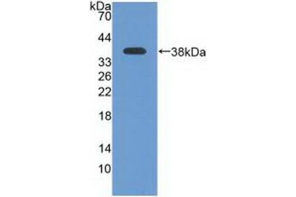 ATR Antikörper  (AA 2353-2644)