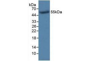WB of Protein Standard: different control antibodies against Highly purified E. (TK1 Kit ELISA)
