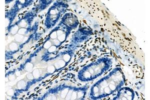 ABIN6263186 and ABIN6273137 at 1/100 staining Rat colorectal tissue by IHC-P. (MECP2 anticorps  (C-Term))