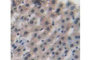 Figure. (IDH1 anticorps  (AA 78-330))