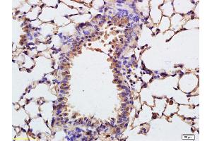 Formalin-fixed and paraffin embedded rat lung labeled with Anti-COL4A3BP Polyclonal Antibody, Unconjugated (ABIN708836) at 1:200 followed by conjugation to the secondary antibody