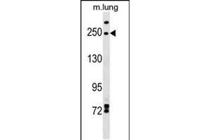 Western blot analysis in mouse lung tissue lysates (35ug/lane). (INF2 anticorps  (AA 589-616))