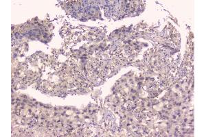 IHC analysis of TNFRSF11B using anti-TNFRSF11B antibody (ABIN7600875).