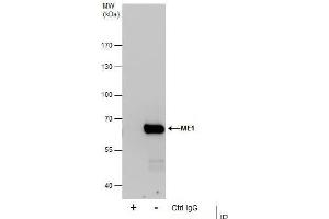 IP Image Immunoprecipitation of ME1 protein from HeLa whole cell extracts using 5 μg of ME1 antibody, Western blot analysis was performed using ME1 antibody, EasyBlot anti-Rabbit IgG  was used as a secondary reagent.