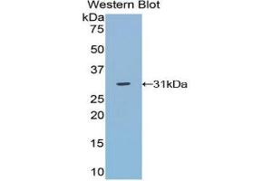 Western Blotting (WB) image for anti-TNFRSF1A-Associated Via Death Domain (TRADD) (AA 21-259) antibody (ABIN3202177) (TRADD anticorps  (AA 21-259))
