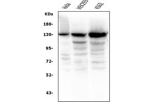 Western blot analysis of BubR1/BUB1B using anti-BubR1/BUB1B antibody (ABIN7600961). (BUB1B anticorps  (AA 26-448))
