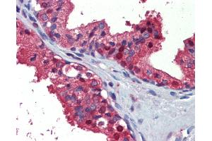 Human, Prostate: Formalin-Fixed Paraffin-Embedded (FFPE) (ACLY anticorps)