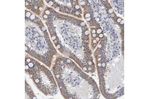 Immunohistochemical staining of human duodenum with ZC3H3 polyclonal antibody  shows moderate cytoplasmic positivity in glandular cells at 1:50-1:200 dilution. (ZC3H3 anticorps)