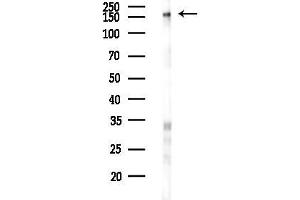 Western blot analysis of lysates from Hela cells(LPS 4h treatment), using Phospho-EGFR (Tyr992)[Tyr1016] Antibody at 1/1000 dilution.