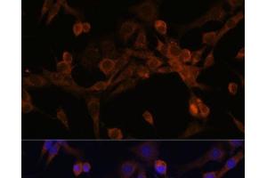Immunofluorescence analysis of NIH/3T3 cells using EIF2B2 Polyclonal Antibody at dilution of 1:100.