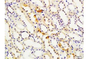Formalin-fixed and paraffin embedded rat kidney labeled with Rabbit Anti S100A4 Polyclonal Antibody, Unconjugated  at 1:200 followed by conjugation to the secondary antibody and DAB staining (s100a4 anticorps  (AA 15-101))