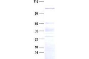 Validation with Western Blot