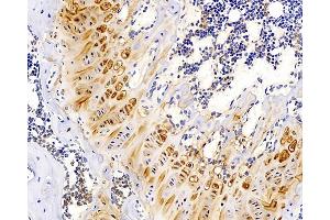 Immunohistochemistry analysis of paraffin-embedded mouse bone using MAGEC1 Polyclonal Antibody at dilution of 1:300. (MAGEC1 anticorps)