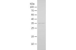Western Blotting (WB) image for Inhibitor of Growth Family, Member 2 (ING2) (AA 1-280) protein (His tag) (ABIN7123427)