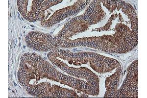 Image no. 8 for anti-V-Ets Erythroblastosis Virus E26 Oncogene Homolog 2 (ETS2) (AA 90-349) antibody (ABIN1491702) (ETS2 anticorps  (AA 90-349))