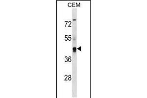 Western blot analysis in CEM cell line lysates (35ug/lane). (Kcng2 anticorps  (AA 149-177))