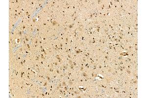 ABIN7093294 and ABIN7097313 at 1/100 staining Rat brain tissue by IHC-P. (ZFP36L1 anticorps  (pSer92))