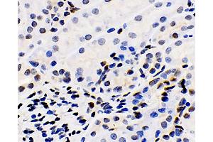 Immunohistochemistry analysis of paraffin-embedded mouse kidney using ERK 2 Polyclonal Antibody at dilution of 1:100. (ERK2 anticorps)