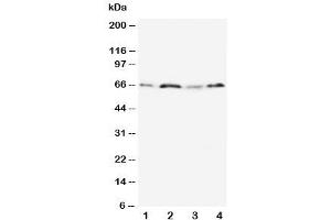 Western blot testing of OPN antibody and Lane 1:  MM231 (Osteopontin anticorps  (N-Term))