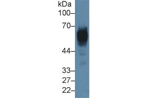 Detection of CK5 in Rat Skin lysate using Polyclonal Antibody to Cytokeratin 5 (CK5)